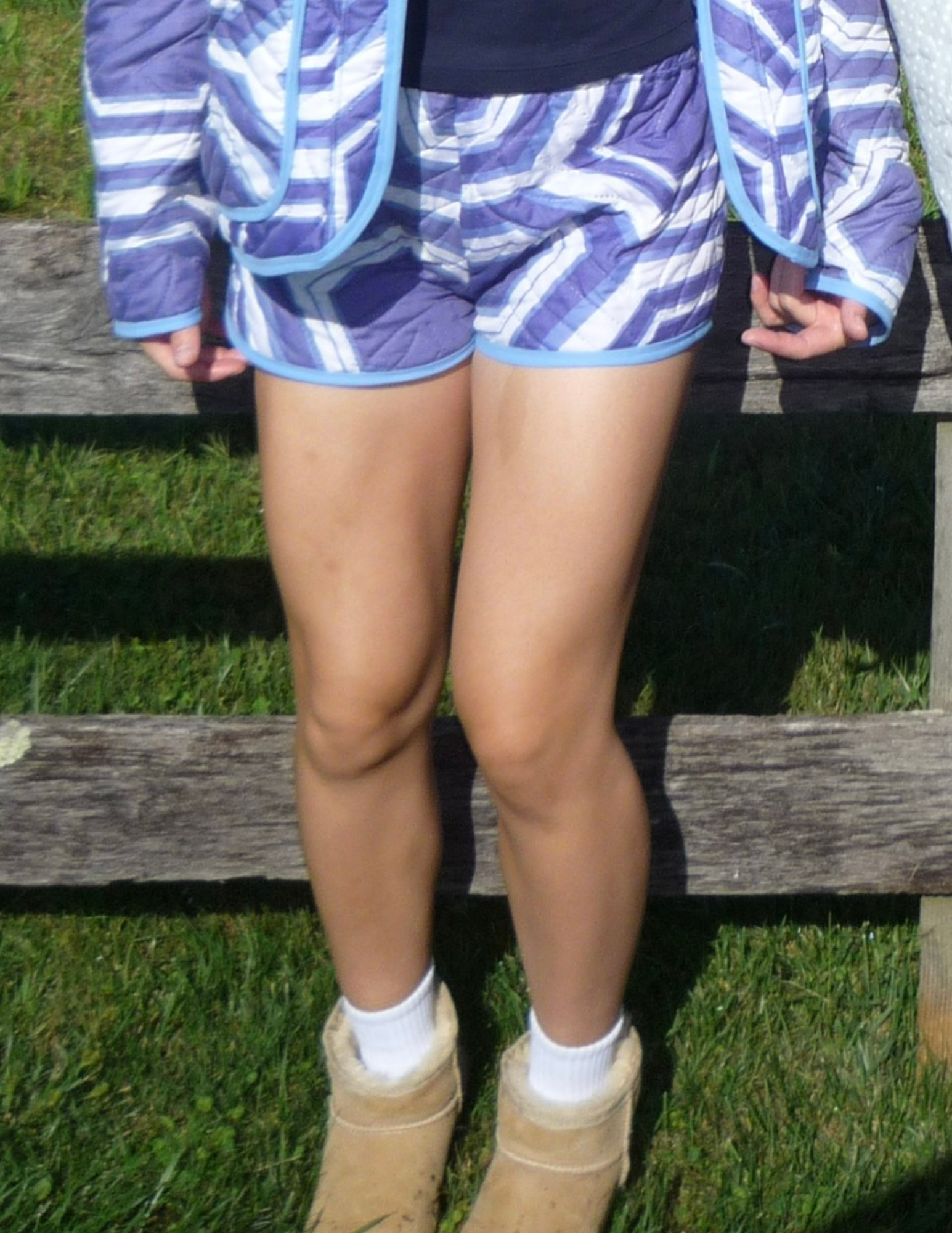 Blue Patterned Mini Shorts